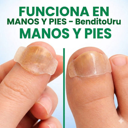 BenditoUru - Parches Antihongos - Eliminan Hongos y Regeneran tus Uñas