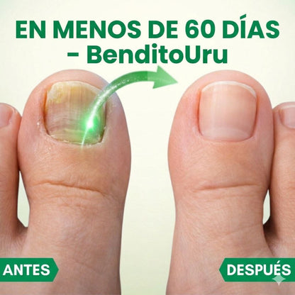 BenditoUru - Parches Antihongos - Eliminan Hongos y Regeneran tus Uñas